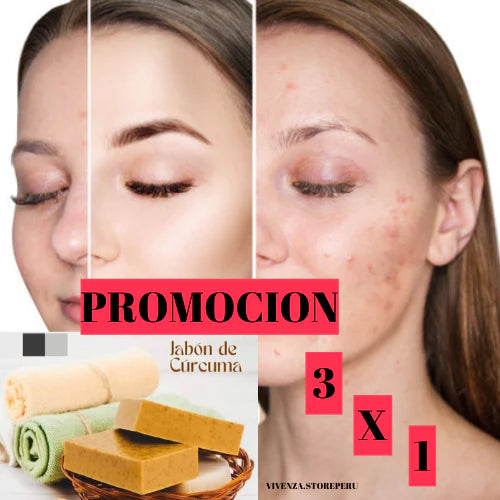 Jabón de Cúrcuma TT